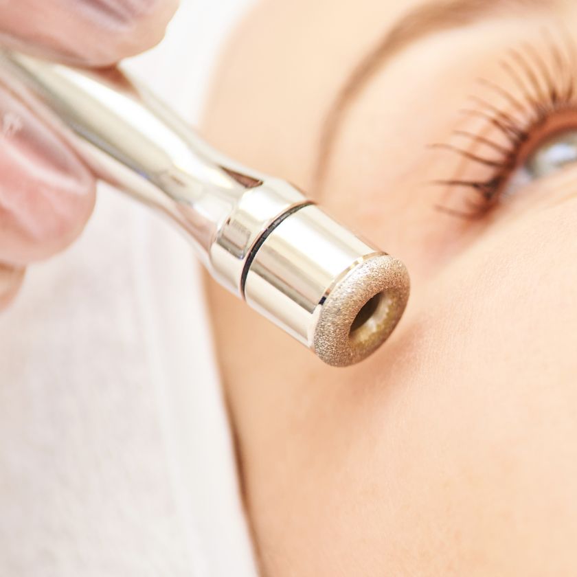 Microdermabrasion Facial at SINIMA Salon